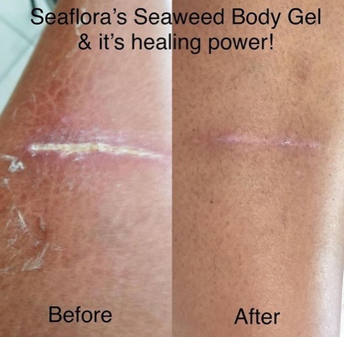 wound healing body gel - Seaflora Skincare Seaweed Body Gel