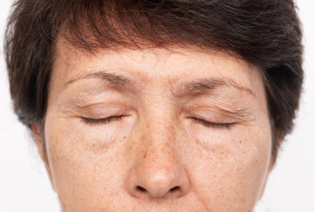 Mature skin with crows feet - Seaflora Skincare seaweed for face care