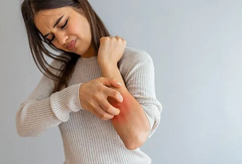 woman with irritated itchy skin