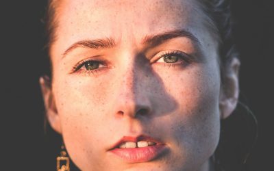 Rosacea — Abolish Rosacea in 4 Easy Steps