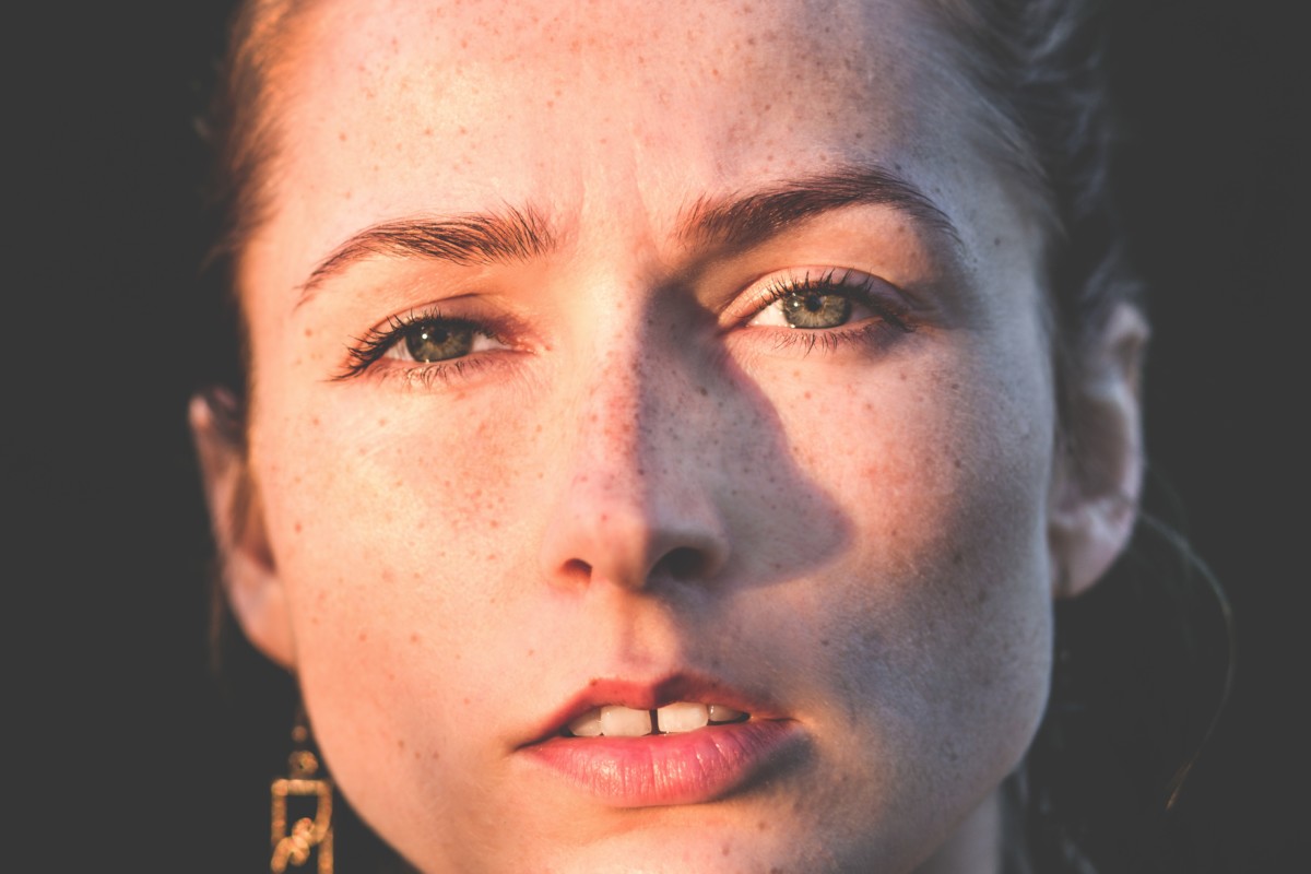 Rosacea — Abolish Rosacea in 4 Easy Steps