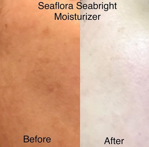 Seabright Moisturizer before and after picture
