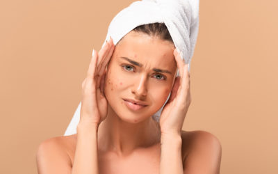 How to Halt Hormonal Acne with Seaflora Skincare