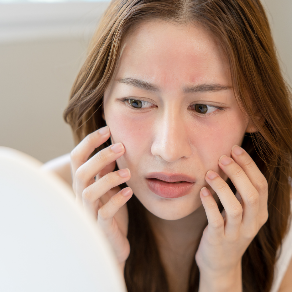 Why is retinol A making my skin red?