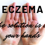 eczema