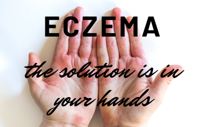 Eczema, Psoriasis, Rosacea: Symptoms, Causes, and Solutions