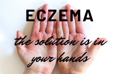 eczema