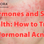 Hormone Health