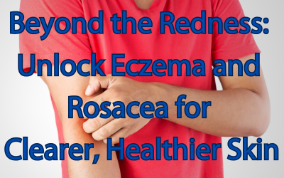 A person wearing a red t-shirt scratching their eczema with the blog title overlay: 'Beyond the Redness: Unlock Eczema and Rosacea for Clearer, Healthier Skin.