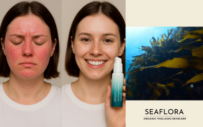 Split-screen blog cover: on the left, a young woman with red, irritated skin looks sad, then smiles with clear skin while holding a Seaflora Skincare product. On the right, brown seaweed sways underwater with the Seaflora logo displayed.